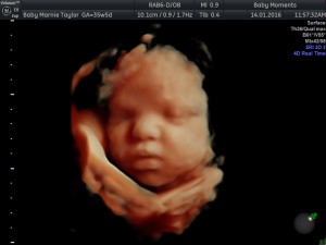 4D Baby scan Northampton